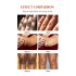 OEM private label dark knuckles whitening serum