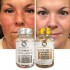 Best High Quality High Dose Glutathione Products Skin Whitening Whitening Skin Care Softgels Collagen Glutathione Capsule
